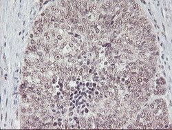 PGAM2 Mouse anti-Human, Clone: OTI1C1, lyophilized, TrueMAB 100 &mu;g;