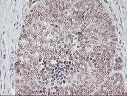 PGAM2 Monoclonal Antibody (OTI1C1), TrueMAB , OriGene 100 &mu;L; Unconjugated:Antibodies,