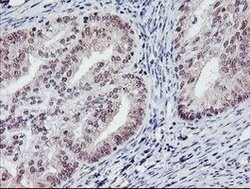 PGAM2 Mouse anti-Human, Clone: OTI1C1, lyophilized, TrueMAB 100 &mu;g;