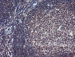 PGAM2 Mouse anti-Human, Clone: OTI1C1, lyophilized, TrueMAB 100 &mu;g;