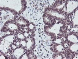 PGAM2 Mouse anti-Human, Clone: OTI1C1, lyophilized, TrueMAB 100 &mu;g;