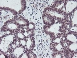 PGAM2 Monoclonal Antibody (OTI1C1), TrueMAB , OriGene 100 &mu;L; Unconjugated:Antibodies,