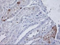 PGAM2 Monoclonal Antibody (OTI1C11), TrueMAB , OriGene:Antibodies:Primary