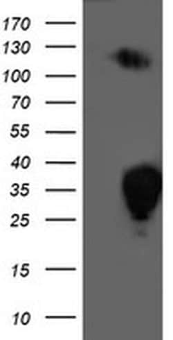 PGAM2 Monoclonal Antibody (OTI4H1), TrueMAB , OriGene:Antibodies:Primary