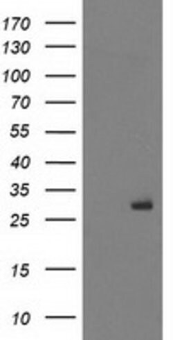PGAM2 Mouse anti-Human, Clone: OTI1E12, lyophilized, TrueMAB 100 &mu;g;