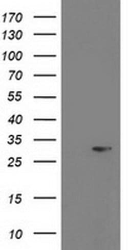 PGAM2 Monoclonal Antibody (OTI3B11), TrueMAB , OriGene 30 &mu;L; Unconjugated:Antibodies,