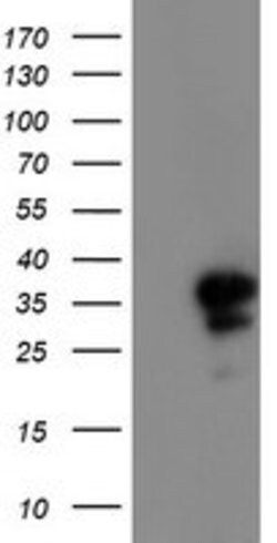 PGAM2 Mouse anti-Human, Clone: OTI1C1, lyophilized, TrueMAB 100 &mu;g;