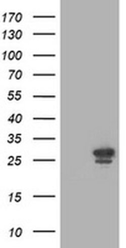 PGAM2 Monoclonal Antibody (OTI1C11), TrueMAB , OriGene 100 &mu;L; Unconjugated:Antibodies,