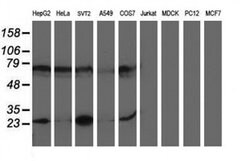 PGAM2 Monoclonal Antibody (OTI4E9), TrueMAB , OriGene 30 &mu;L; Unconjugated:Antibodies,