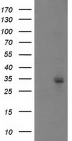 PGAM2 Mouse anti-Canine, Human, Mouse, Clone: OTI4B12, lyophilized, TrueMAB
