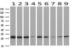PGAM2 Mouse anti-Canine, Human, Mouse, Clone: OTI4B12, lyophilized, TrueMAB