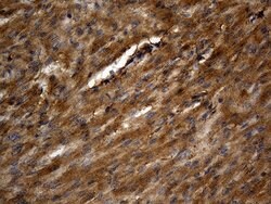 PGAM4 Mouse anti-Human, Clone: OTI1A1, lyophilized, TrueMAB 100 &mu;g;