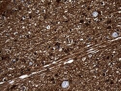 PGAM4 Mouse anti-Human, Clone: OTI1H7, lyophilized, TrueMAB 100 &mu;g;