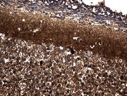 PGAM4 Mouse anti-Human, Clone: OTI2A12, lyophilized, TrueMAB 100 &mu;g;