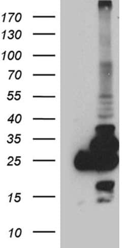 PGAM4 Mouse anti-Human, Clone: OTI1A1, lyophilized, TrueMAB 100 &mu;g;