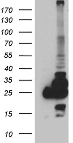 PGAM4 Monoclonal Antibody (OTI1A1), TrueMAB , OriGene 100 &mu;L; Unconjugated:Antibodies,