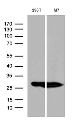 PGAM4 Monoclonal Antibody (OTI1A1), TrueMAB , OriGene 100 &mu;L; Unconjugated:Antibodies,