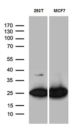 PGAM4 Monoclonal Antibody (OTI1H7), TrueMAB , OriGene 100 &mu;L; Unconjugated:Antibodies,