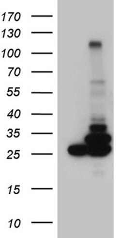 PGAM4 Mouse anti-Human, Clone: OTI3F9, lyophilized, TrueMAB 100 &mu;g;
