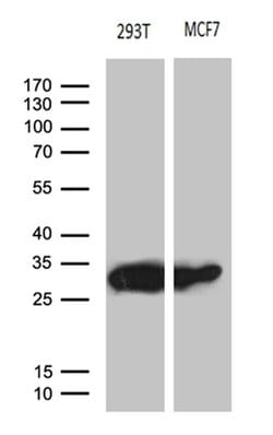 PGAM4 Monoclonal Antibody (OTI3F9), TrueMAB , OriGene 100 μL; Unconjugated:Antibodies,