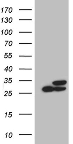 PGAM4 Mouse anti-Human, Clone: OTI2A12, lyophilized, TrueMAB 100 &mu;g;