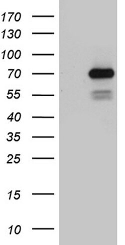 PGBD3 Mouse anti-Human, Clone: OTI3H1, lyophilized, TrueMAB 100 &mu;g;
