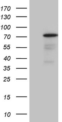 PGBD3 Mouse anti-Human, Clone: OTI1B3, lyophilized, TrueMAB 100 &mu;g;
