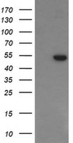 PGD Mouse anti-Human, Clone: OTI2A5, liquid, TrueMAB 100 &mu;L; Unconjugated:Antibodies,