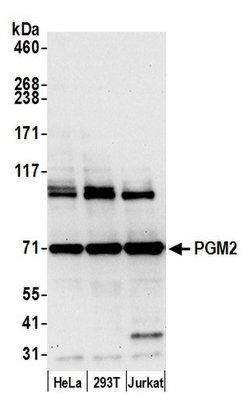 PGM2 Polyclonal Antibody, Bethyl Laboratories 20 &mu;L; Unconjugated:Antibodies,