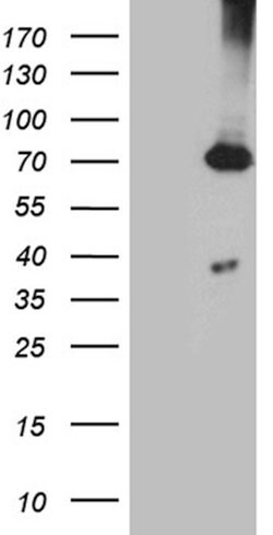 PGM2L1 Monoclonal Antibody (OTI1C2), TrueMAB , OriGene:Antibodies:Primary