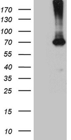 PGM2L1 Monoclonal Antibody (OTI2D12), TrueMAB , OriGene 100 &mu;L; Unconjugated:Antibodies,