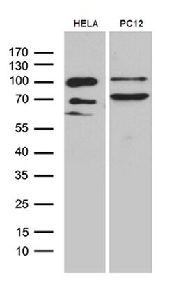 PGM2L1 Monoclonal Antibody (OTI2D12), TrueMAB , OriGene 100 &mu;L; Unconjugated:Antibodies,