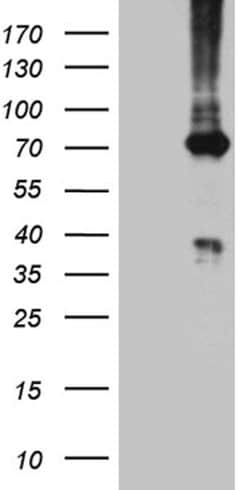 PGM2L1 Monoclonal Antibody (OTI4G6), TrueMAB , OriGene:Antibodies:Primary