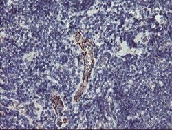 PGM3 Monoclonal Antibody (OTI1B8), TrueMAB , OriGene 100 &mu;L; Unconjugated:Antibodies,