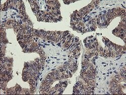 PGM3 Monoclonal Antibody (OTI5C6), TrueMAB , OriGene 30 &mu;L; Unconjugated:Antibodies,