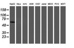 PGM3 Mouse anti-Human, Clone: OTI1B8, lyophilized, TrueMAB 100 &mu;g; Unconjugated:Antibodies,