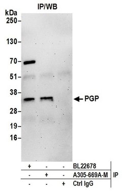 PGP Polyclonal Antibody, Bethyl Laboratories 20 &mu;L; Unconjugated:Antibodies,