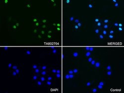PGR Monoclonal Antibody (OTI11E8), TrueMAB , OriGene 100 &mu;L; Unconjugated:Antibodies,