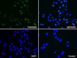 PGR Mouse anti-Human, Clone: OTI34G6, lyophilized, TrueMAB 100 &mu;g; Unconjugated:Antibodies,