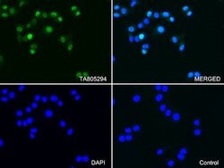 PGR Mouse anti-Human, Clone: OTI31D9, lyophilized, TrueMAB 100 &mu;g; Unconjugated:Antibodies,