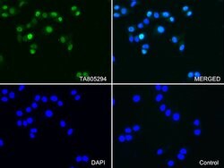 PGR Monoclonal Antibody (OTI31D9), TrueMAB , OriGene 30 &mu;L; Unconjugated:Antibodies,