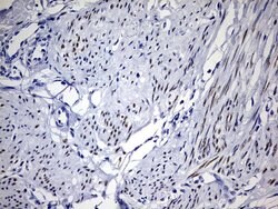 PGR Monoclonal Antibody (OTI12D1), TrueMAB , OriGene:Antibodies:Primary
