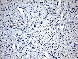 PGR Monoclonal Antibody (OTI12D1), TrueMAB , OriGene:Antibodies:Primary