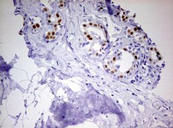 PGR Monoclonal Antibody (OTI4B3), TrueMAB , OriGene 100 &mu;L; Unconjugated:Antibodies,