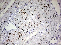 PGR Mouse anti-Human, Clone: OTI4B3, lyophilized, TrueMAB 100 &mu;g; Unconjugated:Antibodies,