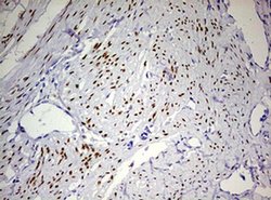 PGR Monoclonal Antibody (OTI4B3), TrueMAB , OriGene 100 &mu;L; Unconjugated:Antibodies,
