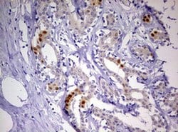 PGR Monoclonal Antibody (OTI11E8), TrueMAB , OriGene:Antibodies:Primary