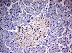 PGR Monoclonal Antibody (OTI11E8), TrueMAB , OriGene 100 &mu;L; Unconjugated:Antibodies,