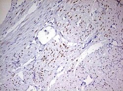 PGR Monoclonal Antibody (OTI11E8), TrueMAB , OriGene 100 &mu;L; Unconjugated:Antibodies,