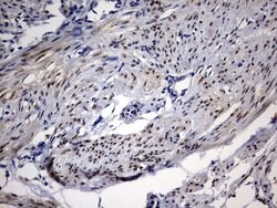 PGR Mouse anti-Human, Clone: OTI20A1, lyophilized, TrueMAB 100 &mu;g; Unconjugated:Antibodies,